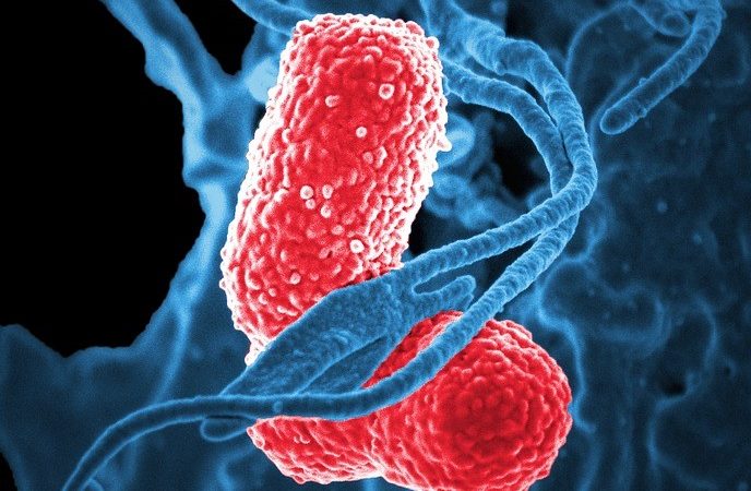 Possible Outbreak of Legionnaires’ Disease at McLaren Macomb Hospital