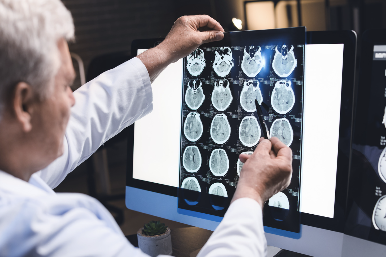 Buckfire Law Brain Injury Lawyers